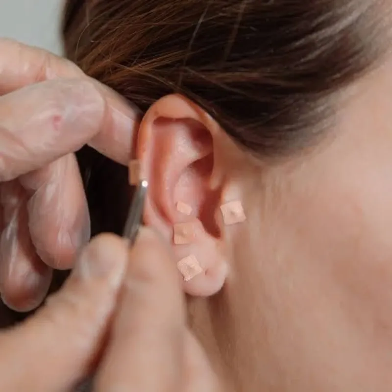 Auriculoterapia (20 min )