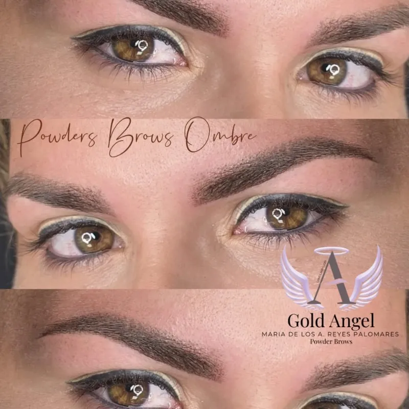 Retoque de Dos Delineados Superiores Antes de 6 Meses.