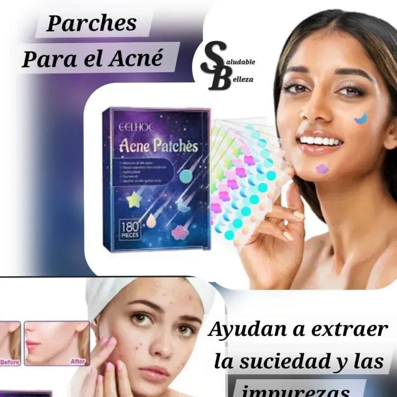 Parches para el Acné