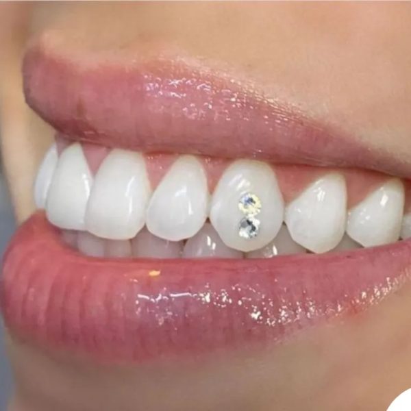 Joyas Dentales
