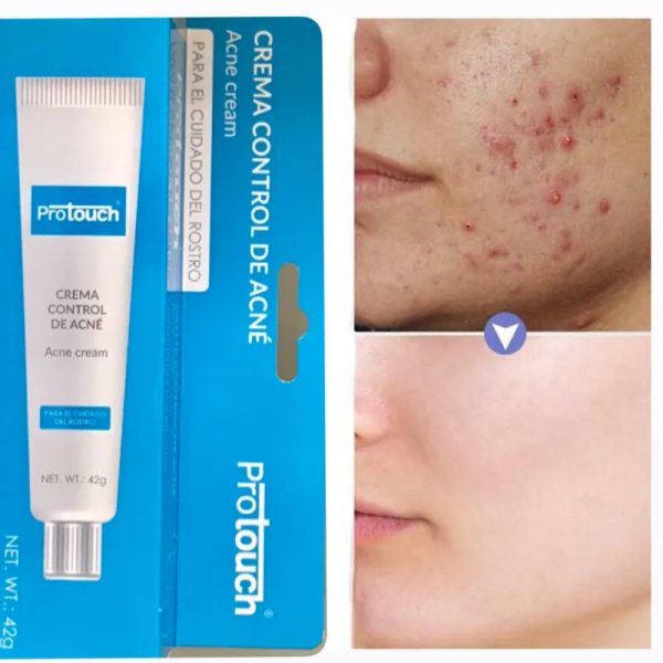 Crema Control de Acné 42g