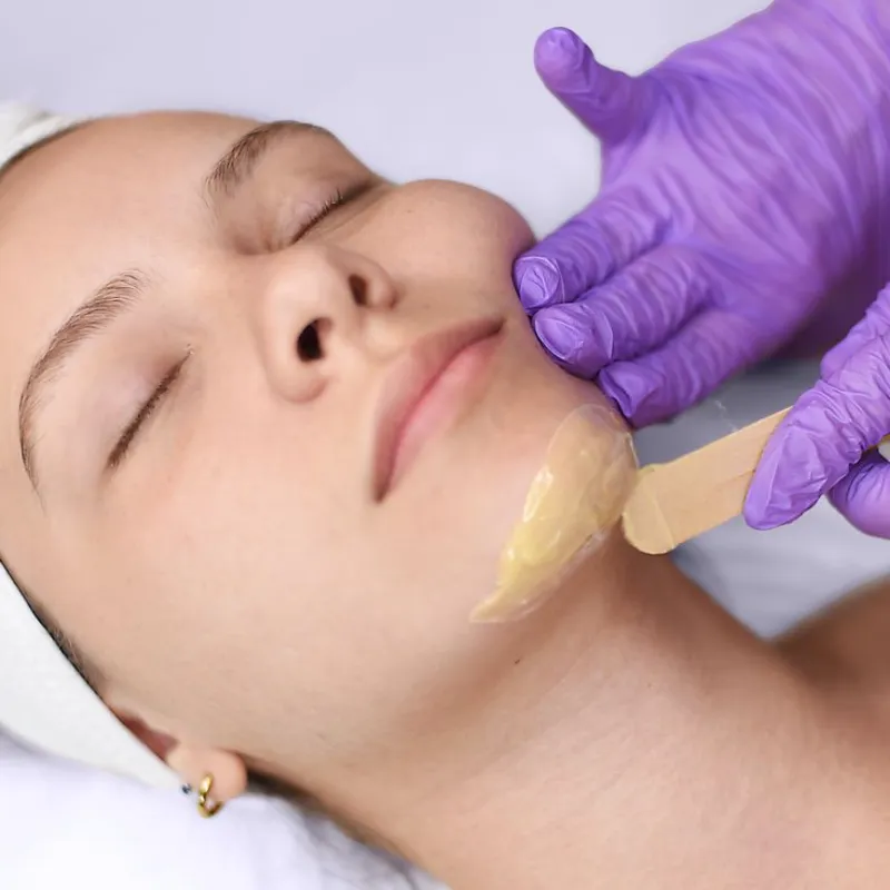 Depilación de mentón 