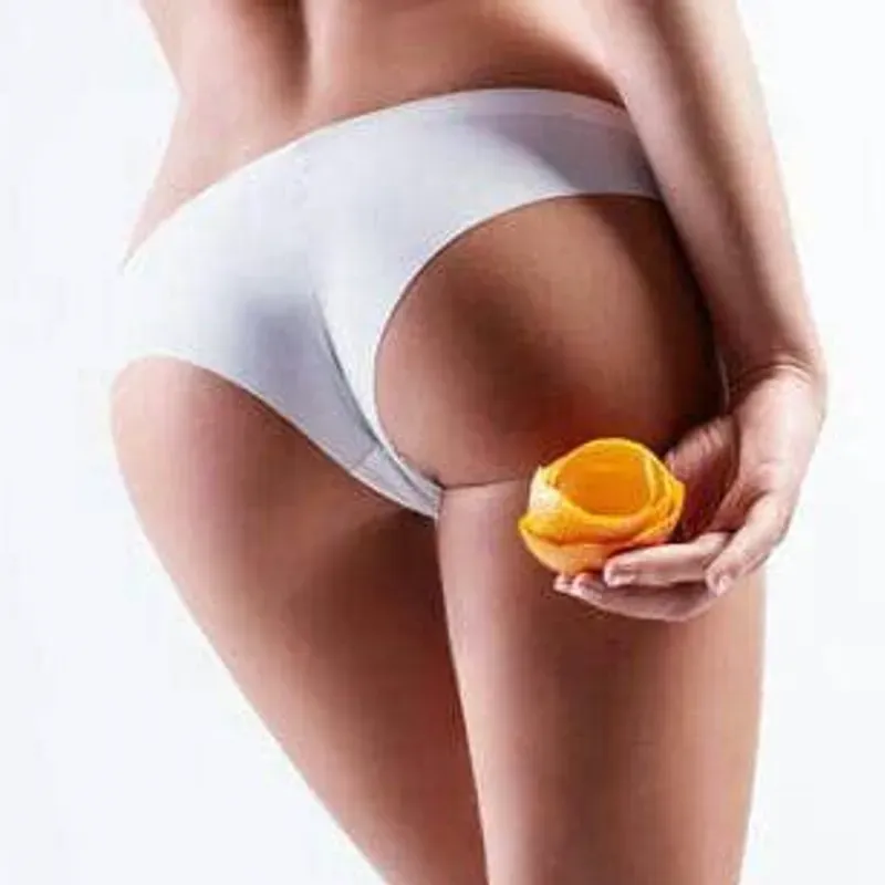 Depilación de glúteos