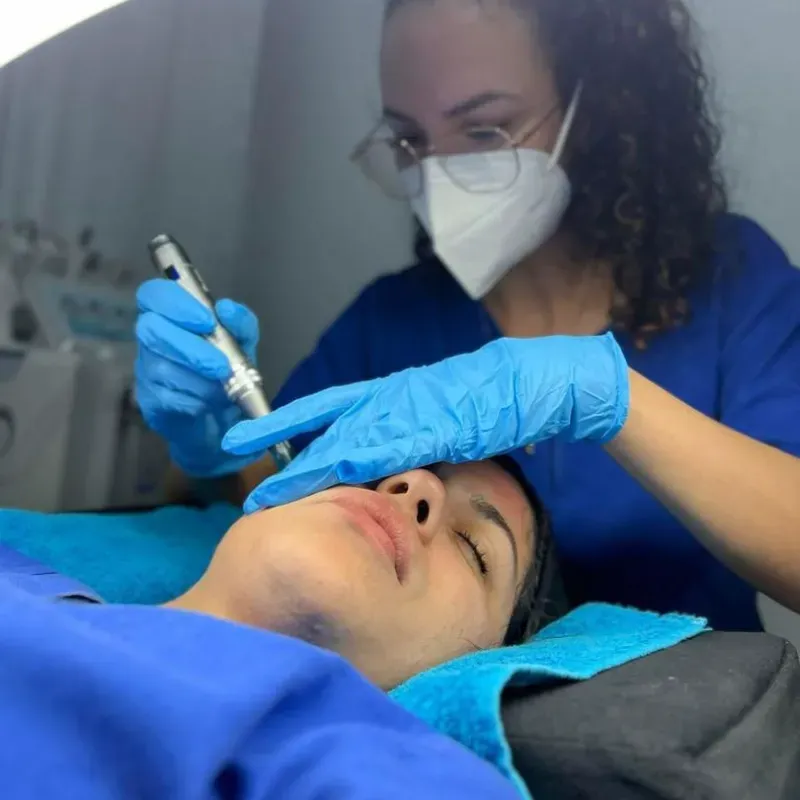 Microneedling con dermapen