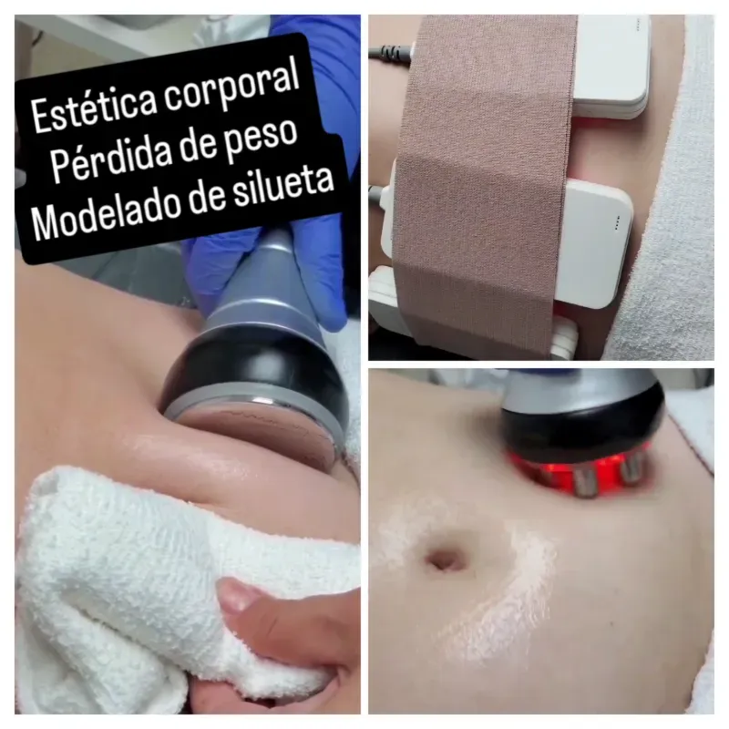 ❤️Ultracavitación + Lipoláser+ Radiofrecuencia+ Vacunterapia