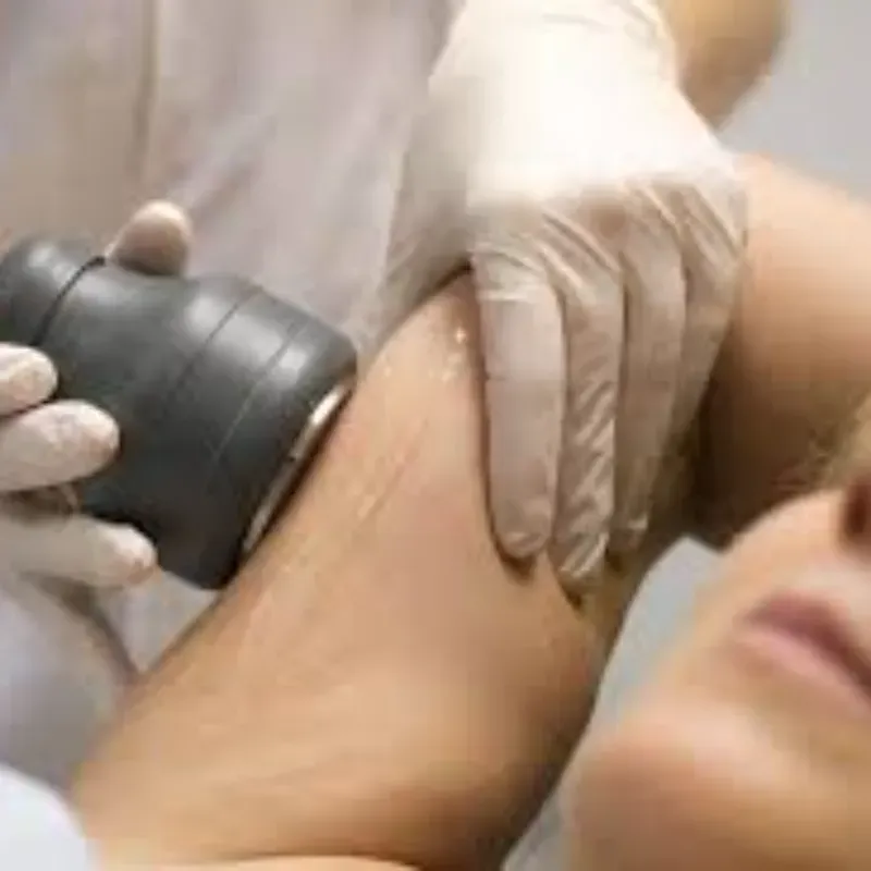 Reductor de brazos paquete 10 sesiones