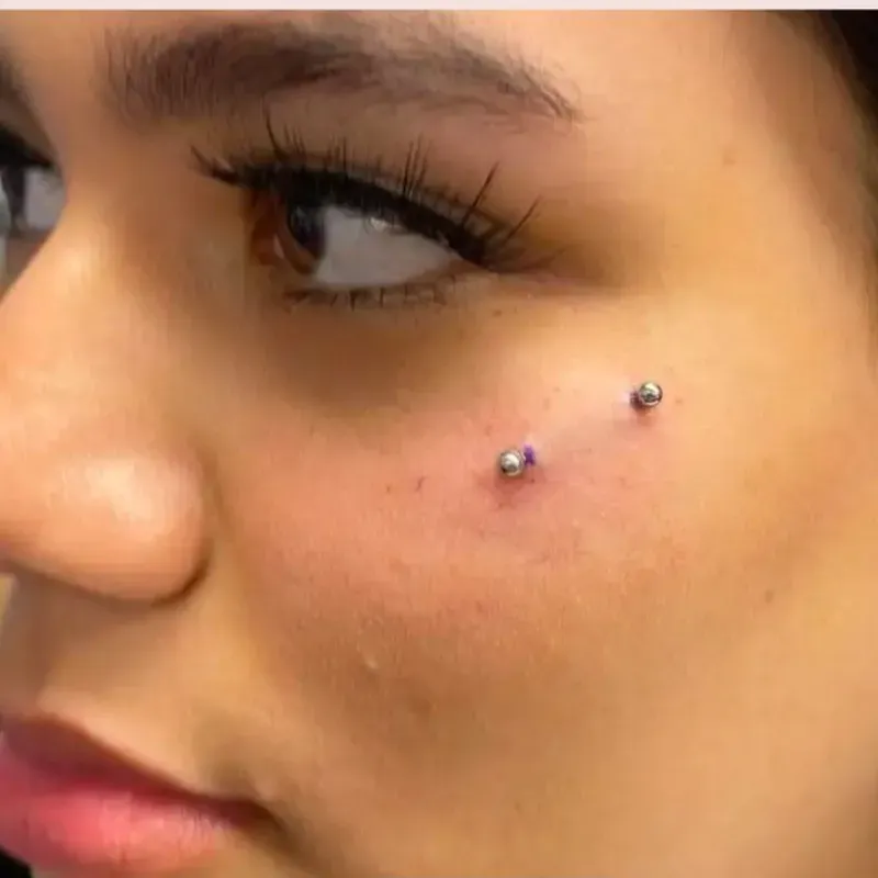 Anticeja (Anti-eyebrow)