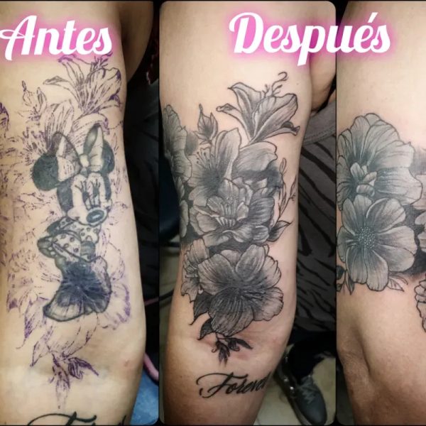 Frontal del brazo