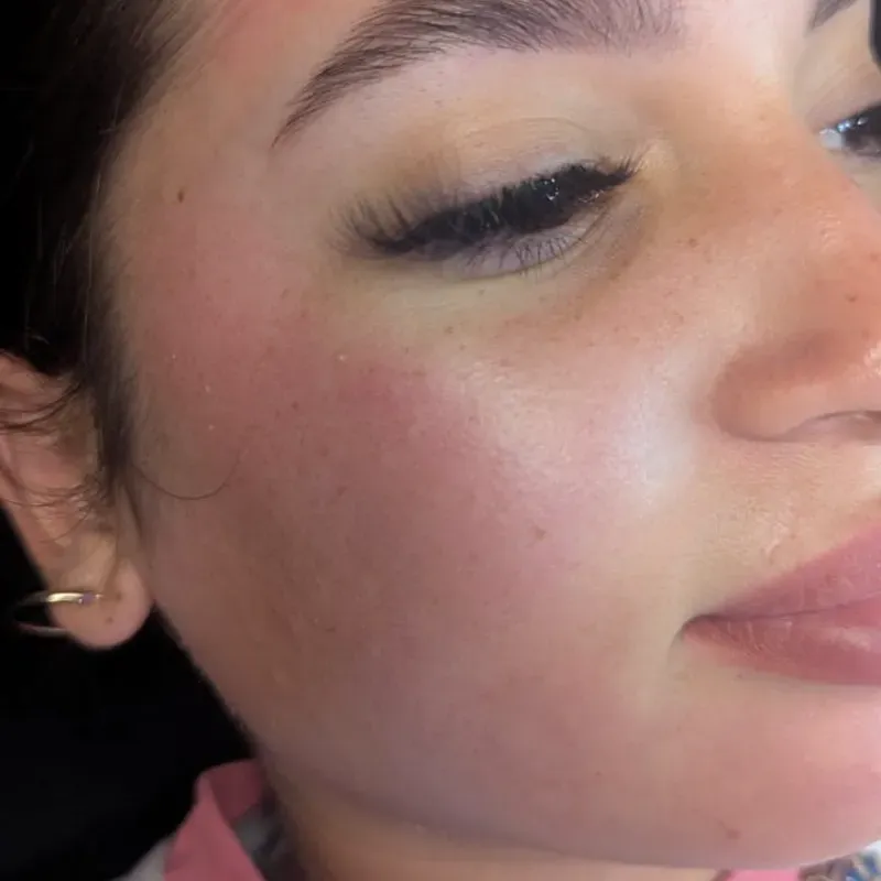 Depilación de Rostro