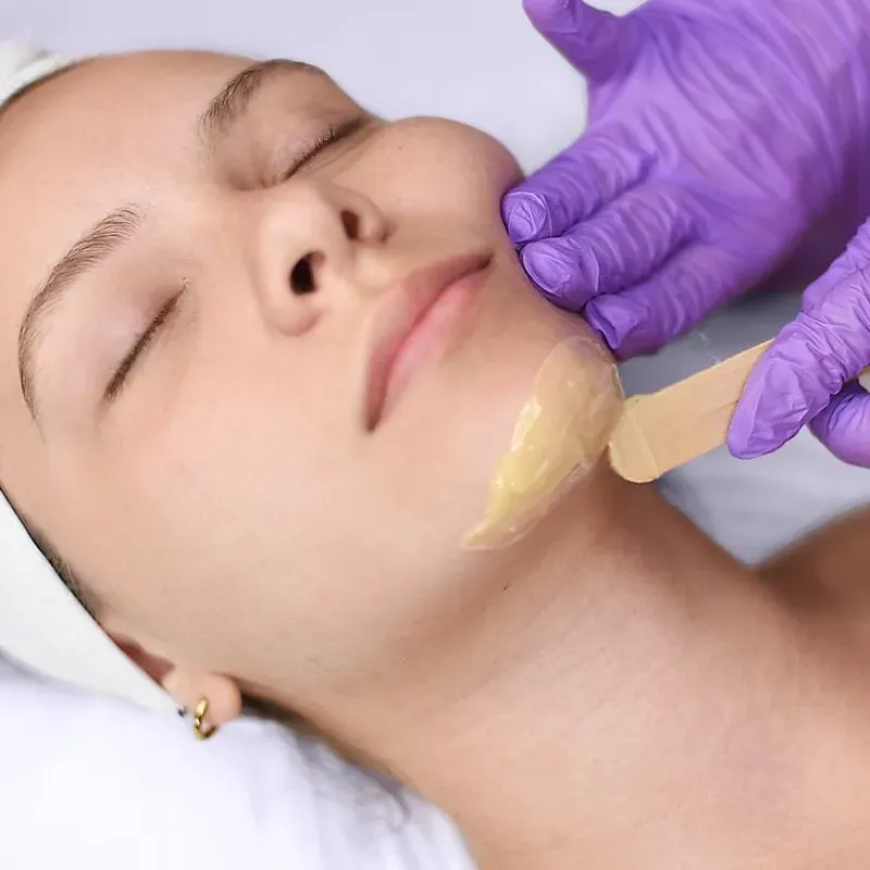 Depilación de mentón