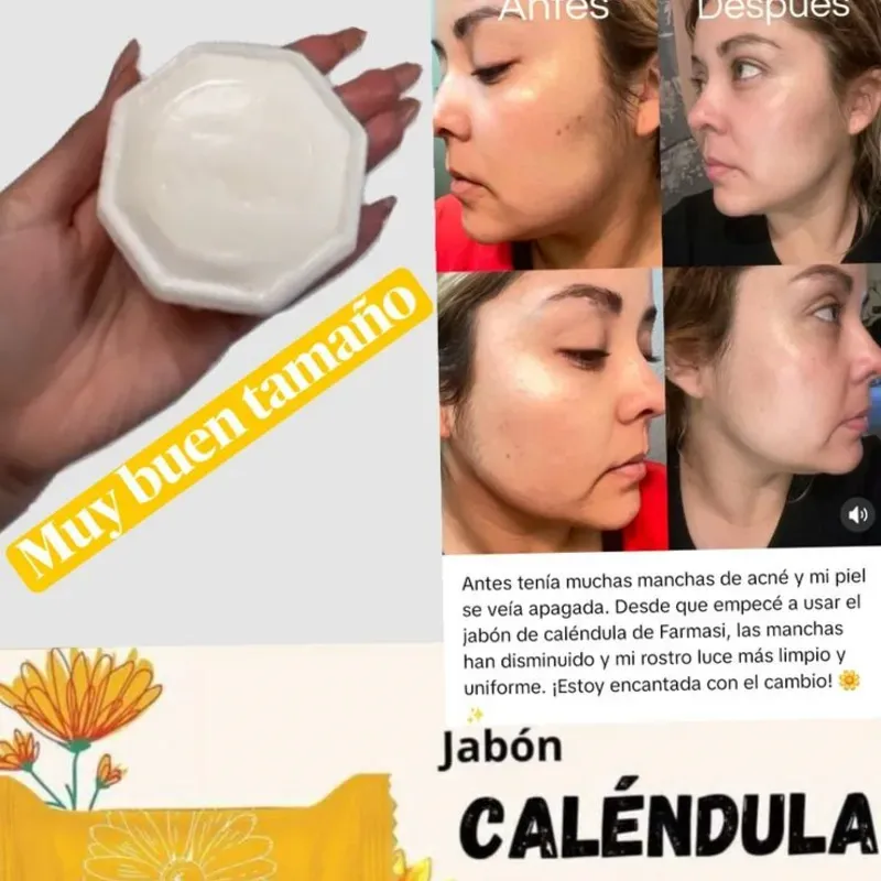 ¡Transformación REAL con el ¡Transformación REAL con el Jabón de Caléndula Farmasi! 