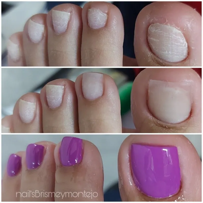 Gel de construcción