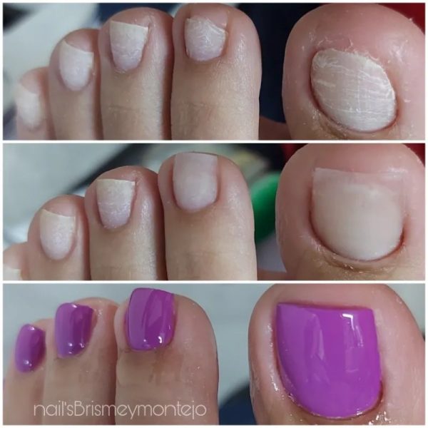 Gel de construcción