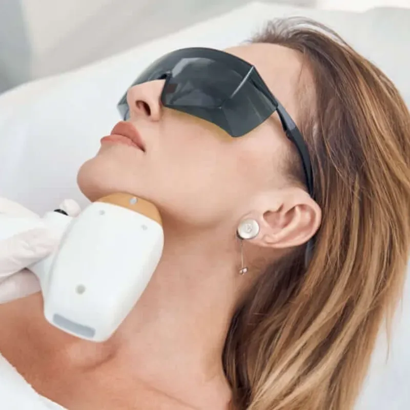 Depilación láser definitiva.