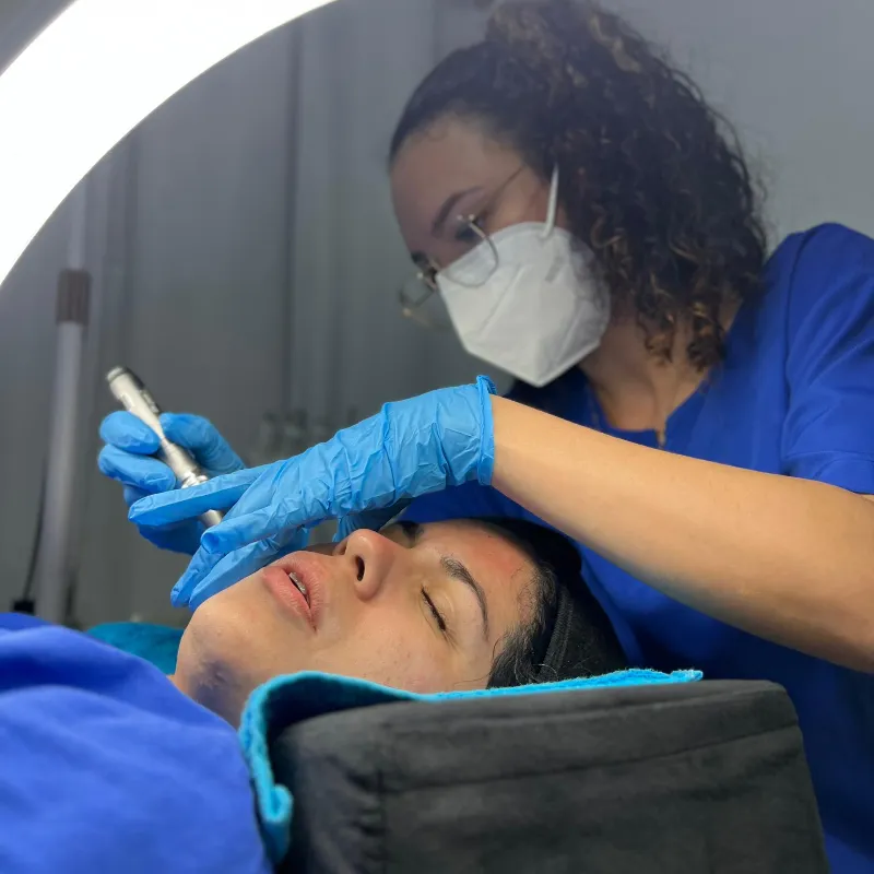 Microneedling con Dermapen