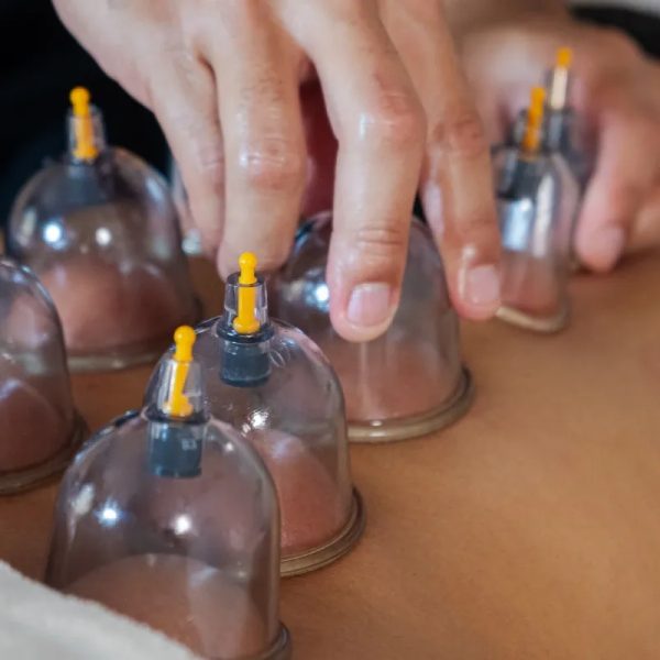Terapia con ventosas (75min )