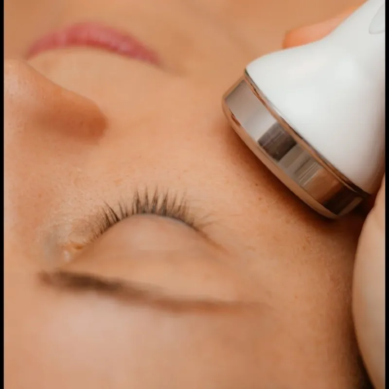 Limpieza facial profunda + Ultrasonido facial.