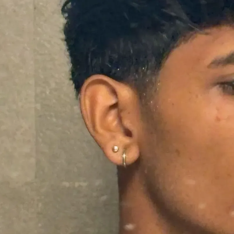 Lóbulo- Lobulo Superior- Triple Lobulo