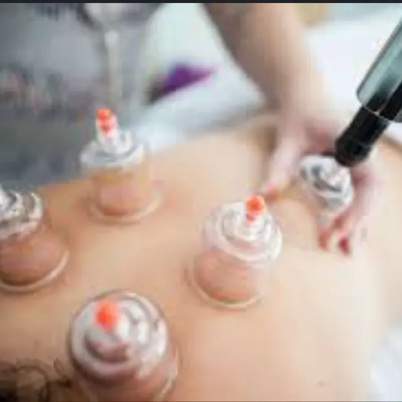 Masaje descontracturante en Espada con Ventosas