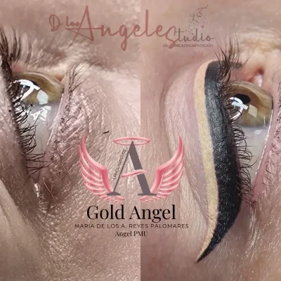 Dos Delineados Superiores.