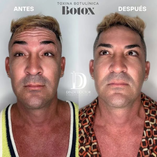 Frente ✨