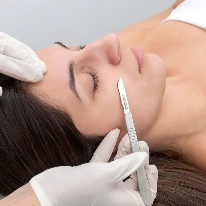 Dermaplaning