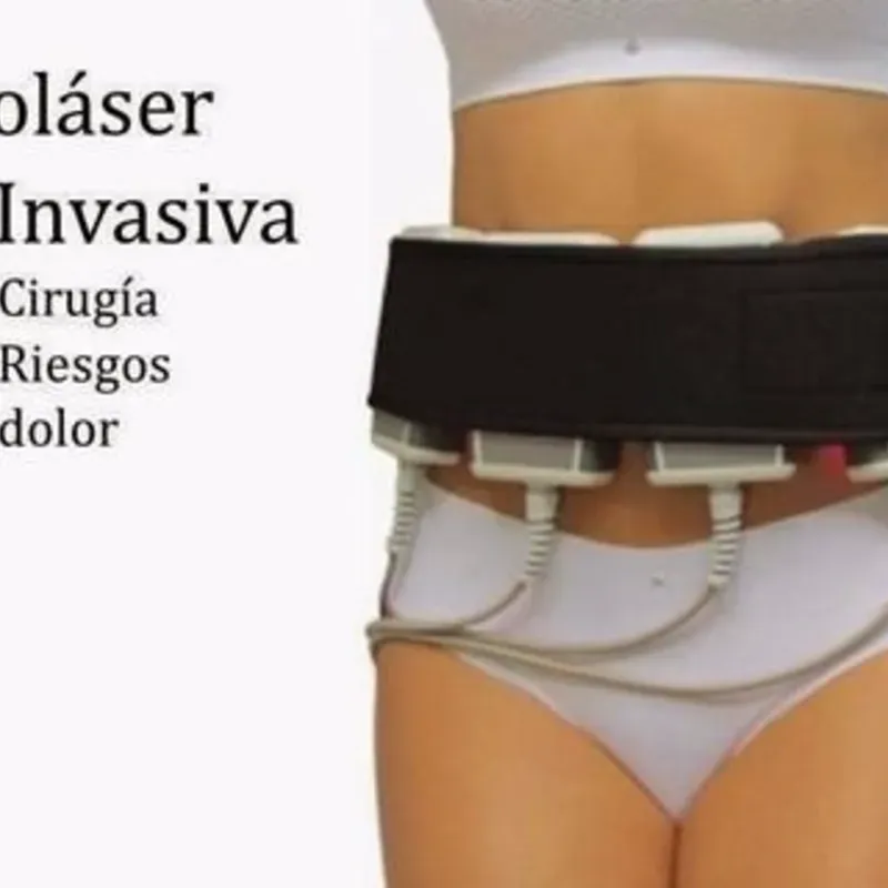 Lipolaser