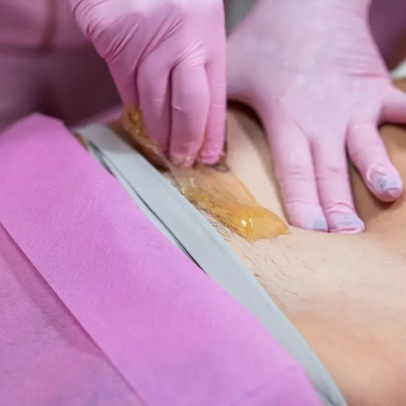 Depilación brasileña