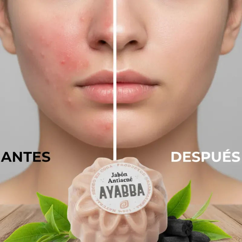 Jabón AntiAcné