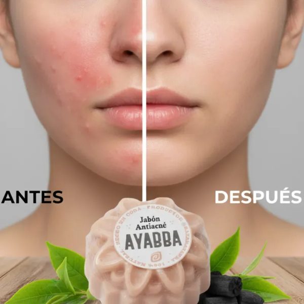 Jabón AntiAcné
