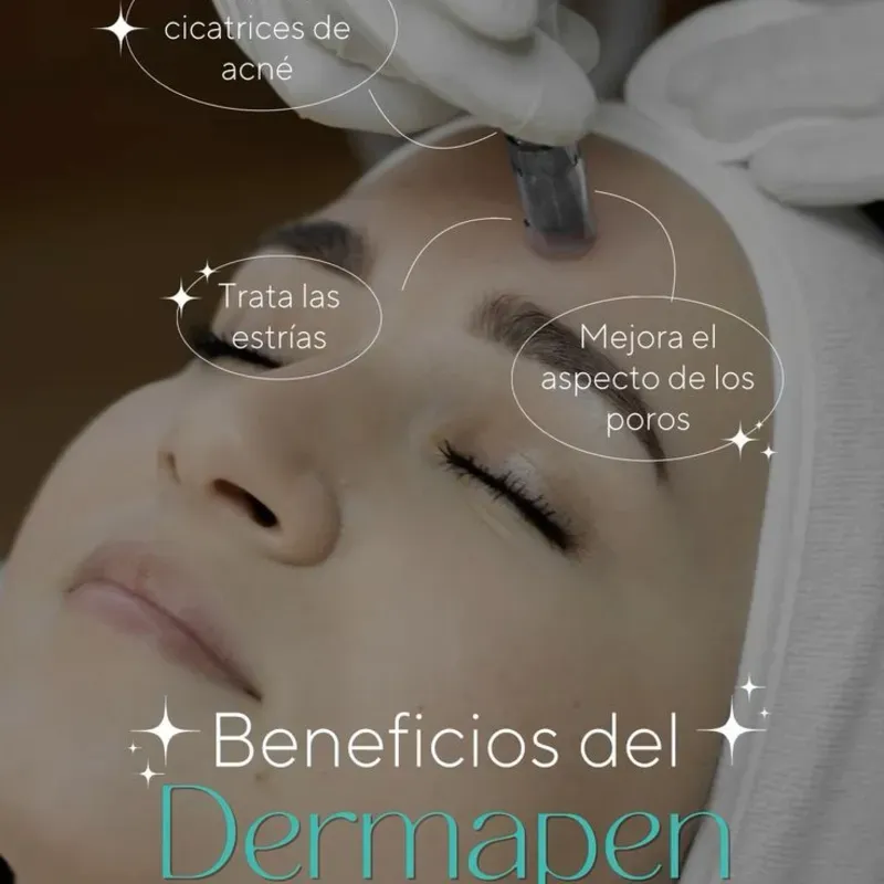 Dermapen o microneedling