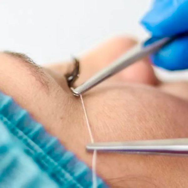 HILOS MÁGICOS REABSORVIBLES_Coreanos