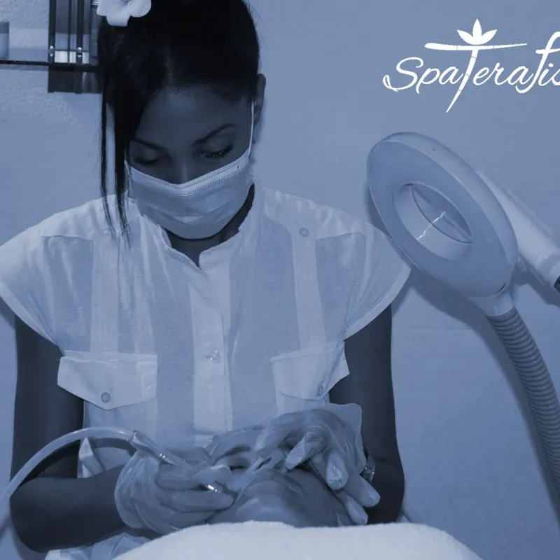 Tratamientos para el acné seborreico